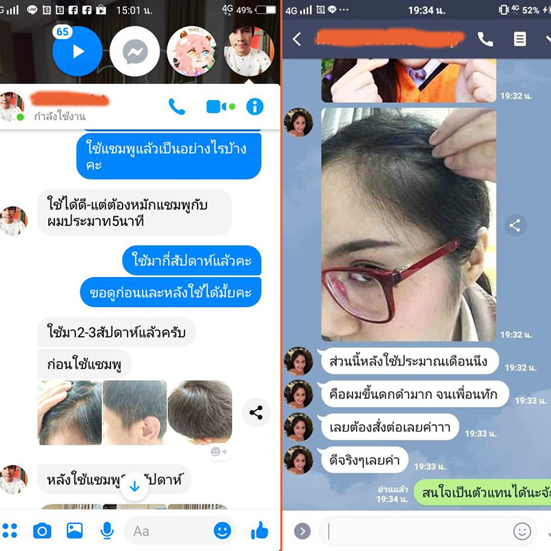 แชมพูแก้ผมร่วง ลดผมร่วง แก้ผมหงอก ขจัดรังแค แชมพูสมุนไพรไทย 7 ชนิด(แพ็ค 2 ขวด แชมพูและครีมนวด)