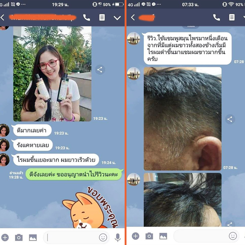 แชมพูแก้ผมร่วง ลดผมร่วง แก้ผมหงอก ขจัดรังแค แชมพูสมุนไพรไทย 7 ชนิด(แพ็ค 2 ขวด แชมพูและครีมนวด)